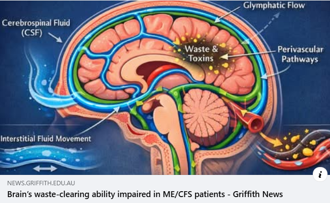 NCNEDResearch's tweet photo. The brain’s waste clearance system is impaired in people living with #MECFS which can lead to various symptoms including brain fog, #GriffithUniversity researchers have discovered. This demonstrates, for the first time, the impact #MECFS has on glymphatic function which is..... https://t.co/RZJbnHBTmB