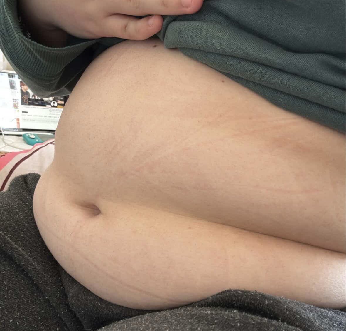00debu's tweet photo. 誰かはなそー
 #ssbbw 
 #ぽっちゃり好きに刺され 
 #ぽっちゃり女子 
 #ぽっちゃり女子と繋がりたい
 #ぽっちゃりさんと繋がりたい https://t.co/RGsuK7cjrw