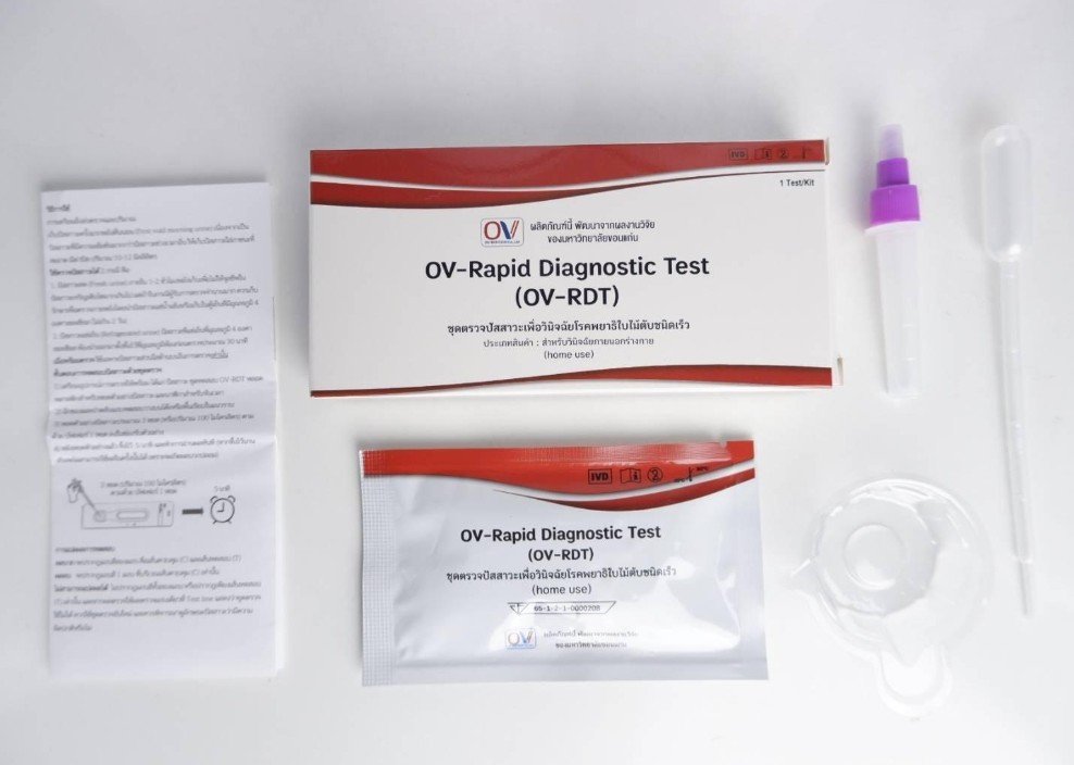 joe_black317's tweet photo. การตรวจคัดกรองพยาธิใบไม้ตับแบบใหม่จากปัสสาวะ หรือ Urine antigen test (OV-RDT) เป็นเทคโนโลยีที่นักวิจัยไทยพัฒนาขึ้นเพื่อใช้คัดกรองการติดเชื้อพยาธิใบไม้ตับ (Opisthorchis viverrini) ในพื้นที่เสี่ยง โดยเฉพาะภาคตะวันออกเฉียงเหนือ 

▪️หลักการตรวจ

ใช้ตัวอย่าง ปัสสาวะ ไม่ต้องเก็บอุจจาระ

ตรวจหา แอนติเจน (Antigen) หรือโปรตีนที่พยาธิปล่อยออกมาในร่างกาย

ลักษณะคล้ายชุดตรวจ ATK คืออ่านผลจากแถบตรวจ ใช้เวลาประมาณ 15–20 นาทีในรุ่นตรวจเร็ว (OV-RDT) 

▪️ข้อดี

เก็บตัวอย่างง่าย ผู้เข้ารับการตรวจยอมรับมากกว่า

มีความไวสูงกว่าวิธีตรวจหาไข่พยาธิในอุจจาระ โดยเฉพาะผู้ที่มีพยาธิจำนวนน้อยหรือยังไม่พบไข่ในอุจจาระ

เหมาะสำหรับการคัดกรองประชากรจำนวนมากในพื้นที่เสี่ยง 

▪️ข้อจำกัด

เป็น การตรวจคัดกรอง ไม่ใช่การยืนยันโรค

หากผลปัสสาวะเป็นบวก ต้องตรวจอุจจาระซ้ำเพื่อหาไข่พยาธิ หรือประเมินเพิ่มเติมตามดุลยพินิจของแพทย์ เพื่อยืนยันการติดเชื้อจริง ซึ่งสอดคล้องกับแนวทางที่ รมว.สาธารณสุขชี้แจง 

▪️ความแม่นยำ

งานวิจัยทบทวนอย่างเป็นระบบ (Systematic Review) รายงานว่า การตรวจหาแอนติเจนในปัสสาวะมี ความไว (Sensitivity) เฉลี่ยประมาณ 91% แต่ความจำเพาะ (Specificity) อยู่ที่ประมาณ 68% จึงเหมาะสำหรับการคัดกรอง และยังต้องมีการตรวจยืนยันในผู้ที่ผลเป็นบวก

ปัจจุบัน การตรวจอุจจาระหาไข่พยาธิยังคงเป็นมาตรฐานในการยืนยันการติดเชื้อ ขณะที่ Urine antigen test ถูกนำมาใช้เพื่อเพิ่มประสิทธิภาพการค้นหาผู้ติดเชื้อในวงกว้างและช่วยลดการตกหล่นของผู้ป่วย