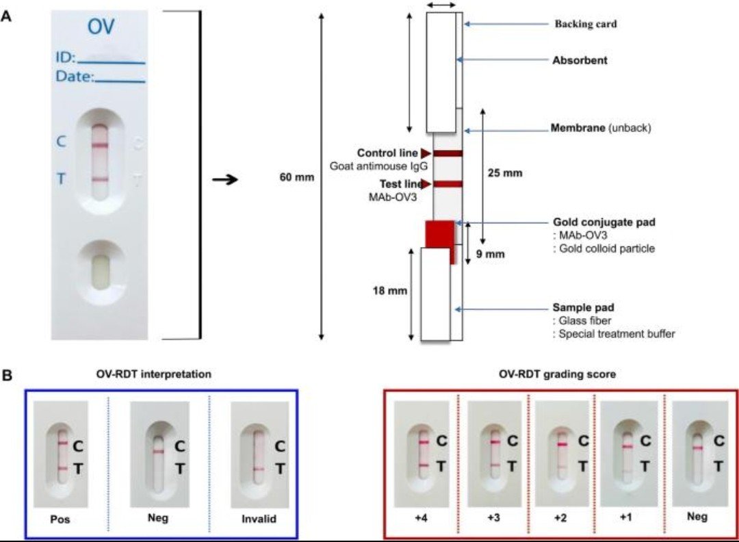 joe_black317's tweet photo. การตรวจคัดกรองพยาธิใบไม้ตับแบบใหม่จากปัสสาวะ หรือ Urine antigen test (OV-RDT) เป็นเทคโนโลยีที่นักวิจัยไทยพัฒนาขึ้นเพื่อใช้คัดกรองการติดเชื้อพยาธิใบไม้ตับ (Opisthorchis viverrini) ในพื้นที่เสี่ยง โดยเฉพาะภาคตะวันออกเฉียงเหนือ 

▪️หลักการตรวจ

ใช้ตัวอย่าง ปัสสาวะ ไม่ต้องเก็บอุจจาระ

ตรวจหา แอนติเจน (Antigen) หรือโปรตีนที่พยาธิปล่อยออกมาในร่างกาย

ลักษณะคล้ายชุดตรวจ ATK คืออ่านผลจากแถบตรวจ ใช้เวลาประมาณ 15–20 นาทีในรุ่นตรวจเร็ว (OV-RDT) 

▪️ข้อดี

เก็บตัวอย่างง่าย ผู้เข้ารับการตรวจยอมรับมากกว่า

มีความไวสูงกว่าวิธีตรวจหาไข่พยาธิในอุจจาระ โดยเฉพาะผู้ที่มีพยาธิจำนวนน้อยหรือยังไม่พบไข่ในอุจจาระ

เหมาะสำหรับการคัดกรองประชากรจำนวนมากในพื้นที่เสี่ยง 

▪️ข้อจำกัด

เป็น การตรวจคัดกรอง ไม่ใช่การยืนยันโรค

หากผลปัสสาวะเป็นบวก ต้องตรวจอุจจาระซ้ำเพื่อหาไข่พยาธิ หรือประเมินเพิ่มเติมตามดุลยพินิจของแพทย์ เพื่อยืนยันการติดเชื้อจริง ซึ่งสอดคล้องกับแนวทางที่ รมว.สาธารณสุขชี้แจง 

▪️ความแม่นยำ

งานวิจัยทบทวนอย่างเป็นระบบ (Systematic Review) รายงานว่า การตรวจหาแอนติเจนในปัสสาวะมี ความไว (Sensitivity) เฉลี่ยประมาณ 91% แต่ความจำเพาะ (Specificity) อยู่ที่ประมาณ 68% จึงเหมาะสำหรับการคัดกรอง และยังต้องมีการตรวจยืนยันในผู้ที่ผลเป็นบวก

ปัจจุบัน การตรวจอุจจาระหาไข่พยาธิยังคงเป็นมาตรฐานในการยืนยันการติดเชื้อ ขณะที่ Urine antigen test ถูกนำมาใช้เพื่อเพิ่มประสิทธิภาพการค้นหาผู้ติดเชื้อในวงกว้างและช่วยลดการตกหล่นของผู้ป่วย