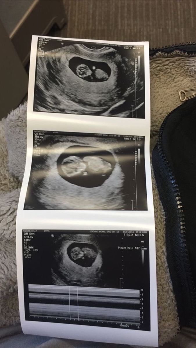 imchaowan's tweet photo. oh my god！ 
After only three days of marriage, Taylor Swift announced that she was pregnant with twins.
What a double blessing! Congratulations!💐 https://t.co/SOcUyvXxbm