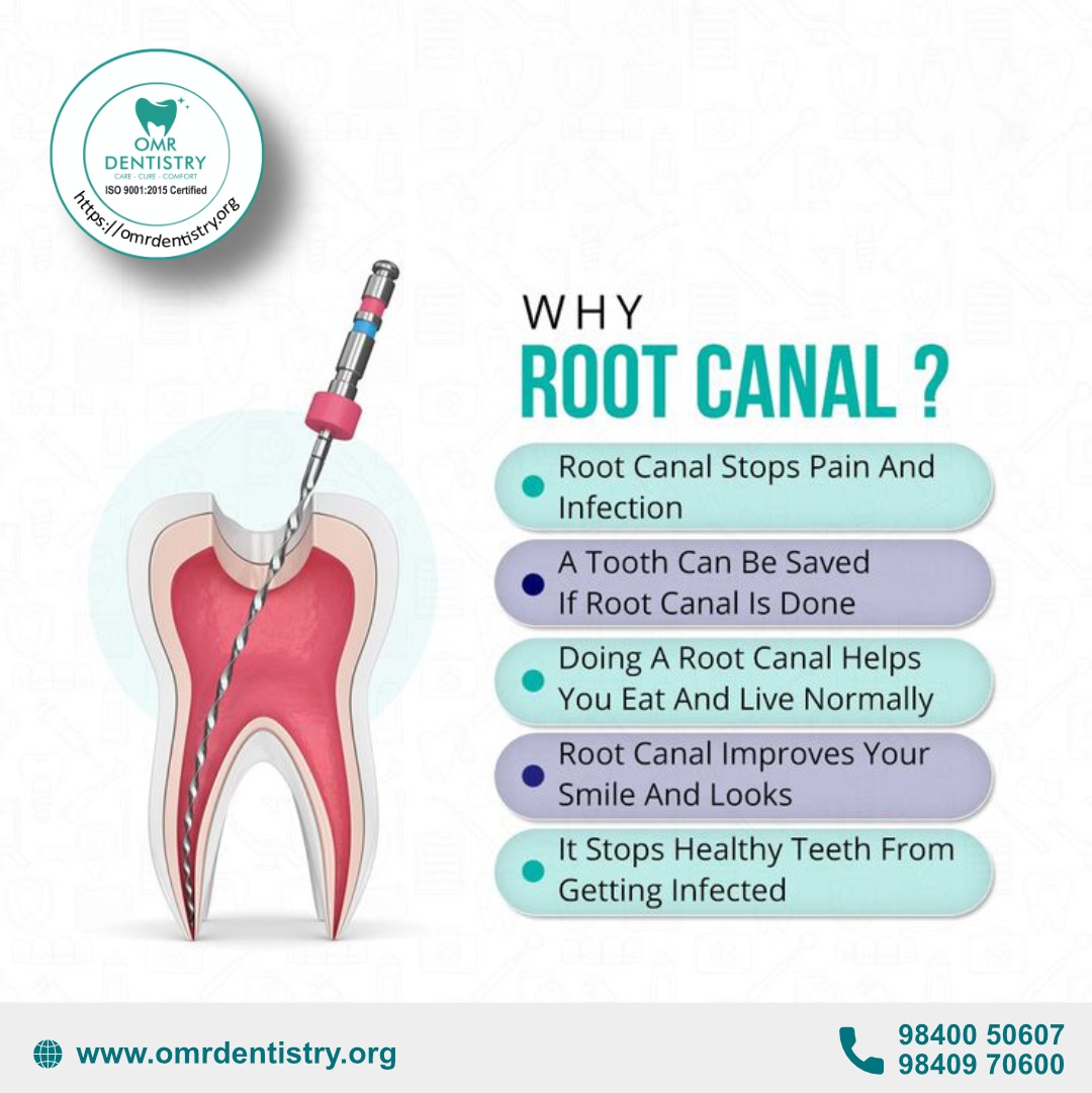 DentistryOmr's tweet photo. Don't let tooth pain take over your day. A root canal can relieve infection, save your natural tooth, and restore your healthy smile. 🦷✨ https://t.co/ddKyBVOSko