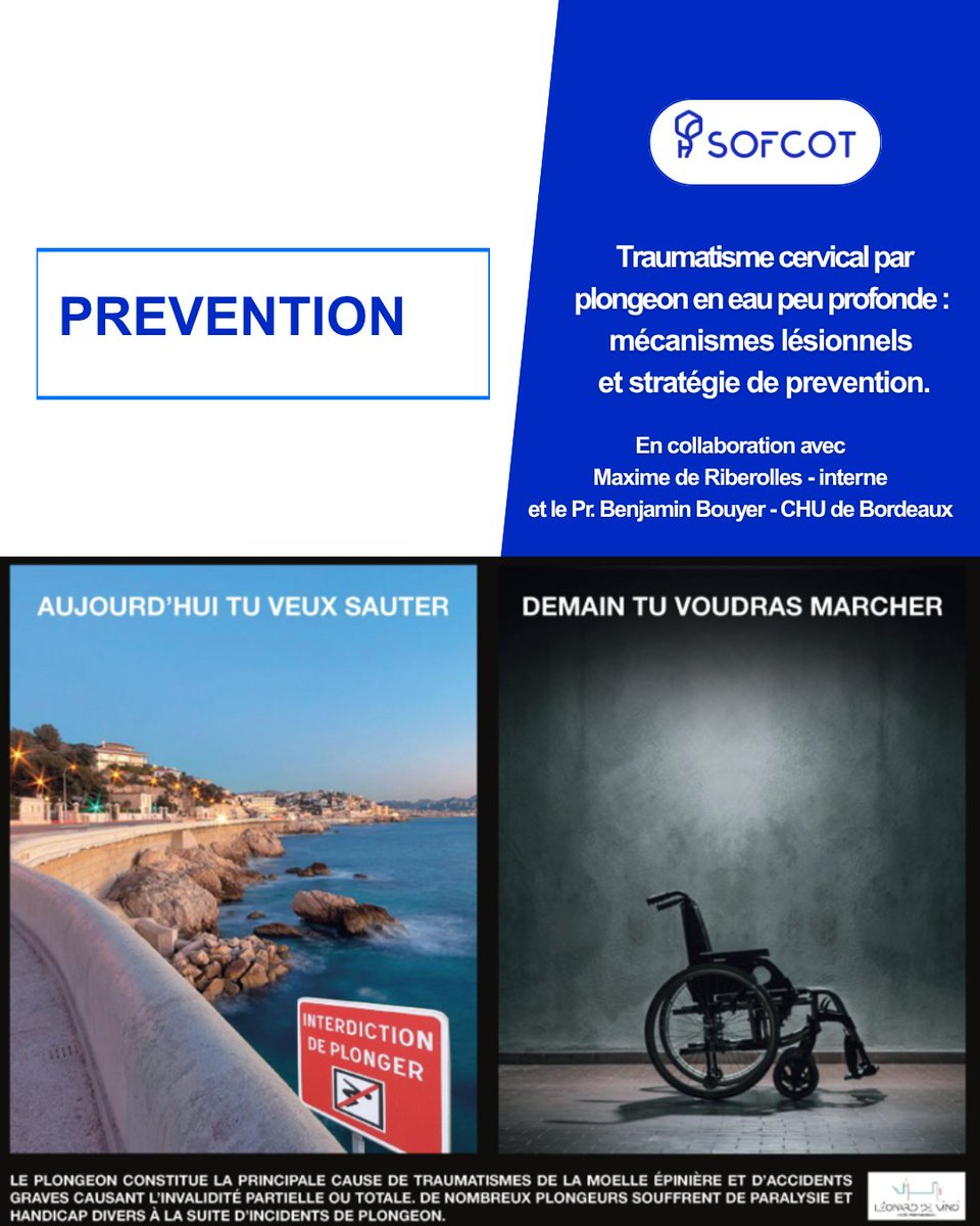sofcot_ortho's tweet photo. 🌊 Le plongeon en eau peu profonde : une cause évitable de traumatisme médullaire.

Retrouvez l'article de M. de Riberolles (Interne) et au Pr. B. Bouyer (CHU de Bordeaux) 

👉 https://t.co/I08AnmrUqf

#orthopédie #chirurgiedurachis #prévention #SOFCOT #plongeons #chirurgiens https://t.co/PirUV1PKeq