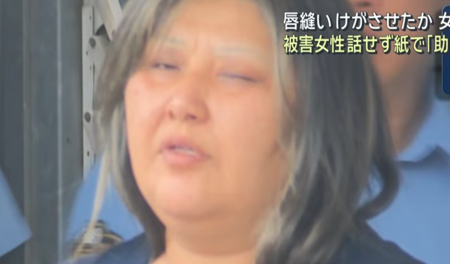 tsuisoku777's tweet photo. 同居する女性の口を糸で縫い付けた櫻井政恵容疑者（49） https://t.co/vK5OOpFzpJ