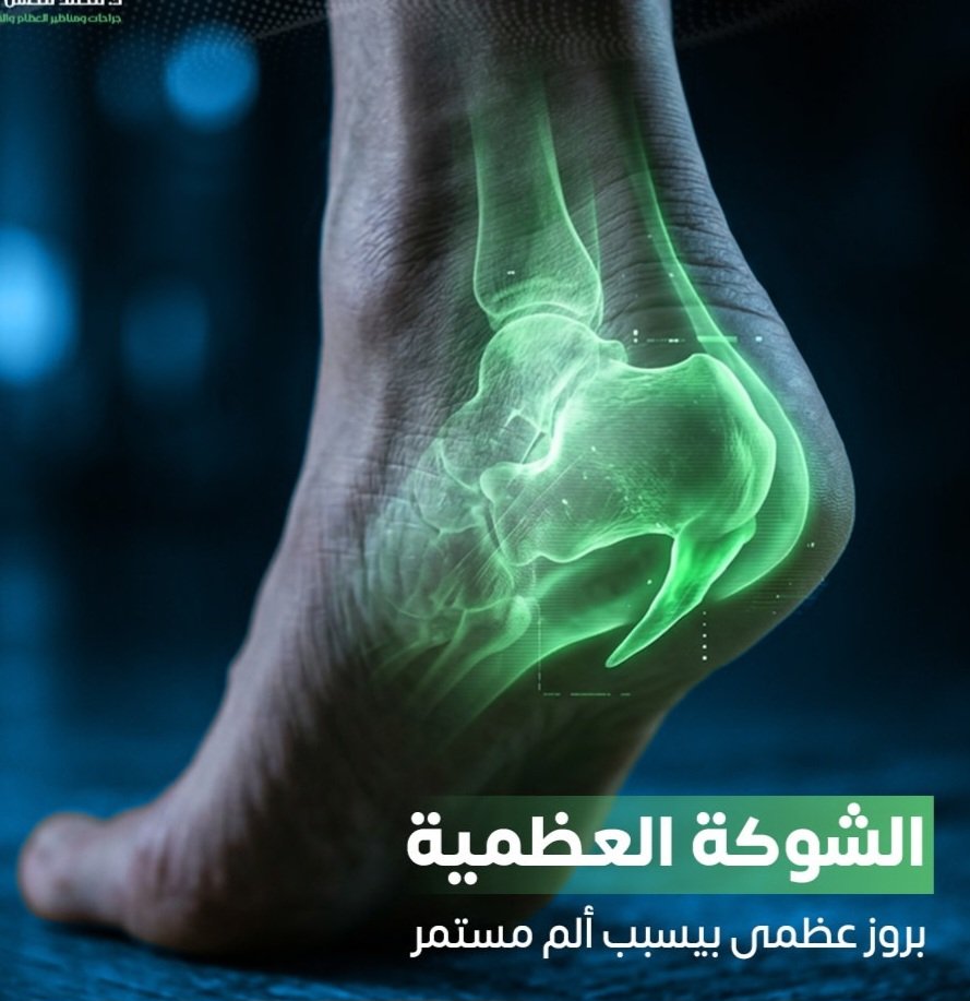Abu_Awys's tweet photo. @l9cc بعض اللاعبين يكون عنده بروز في الكعب https://t.co/MVCSebidE5