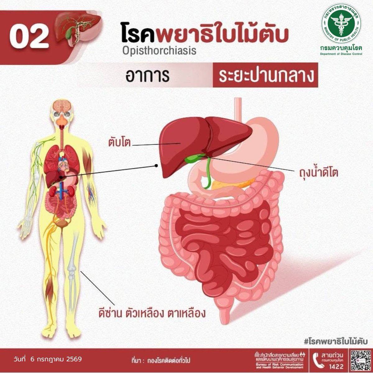 ODPC8UD's tweet photo. #พยาธิใบไม้ตับ ป้องกันได้
กินสุก ปรุงร้อน ไม่กินปลาดิบ 
รู้เสี่ยง ตรวจพบเร็ว รักษาทัน
ป้องกันมะเร็งตับและมะเร็งท่อน้ำดี 

#สคร8อุดรธานี #กรมควบคุมโรค
#กรมควบคุมโรคตรวจจับเร็วตอบโต้ทันป้องกันได้
#กรมควบคุมโรคห่วงใยอย่างเห็นคนไทยมีสุขภาพดี https://t.co/0Gv9TQzEap