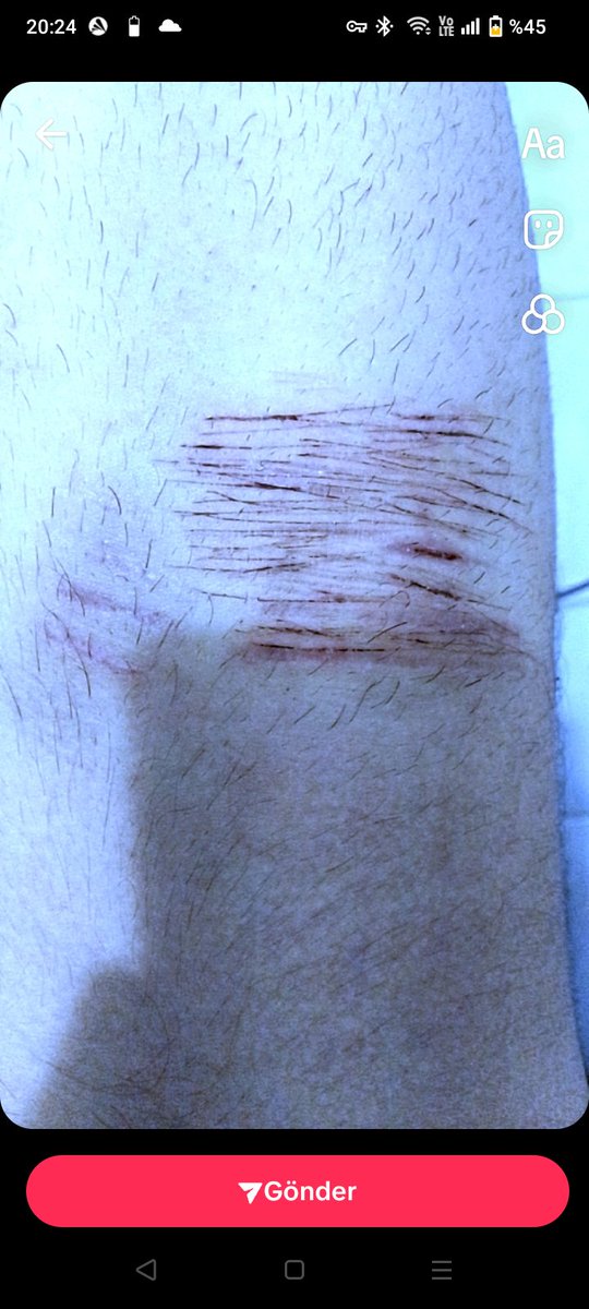meterette's tweet photo. self harm #shtwt #sh https://t.co/eFNOZFcM05