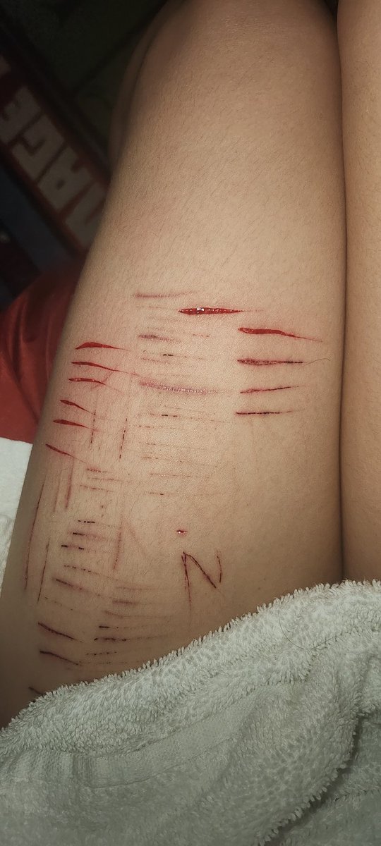 No1hero_Bakugo's tweet photo. Fake fake
Old fresh cuts #shtwt #cutspo #stryo
I wanna crave smth into me soon what should it be 🤤 https://t.co/ebgrjG1pIw