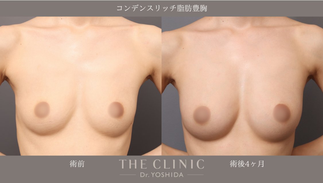 吉田有希 美容外科(JSAPS)専門医|脂肪吸引・豊胸専門_THE CLINIC(ザ・クリニック) tweet media
