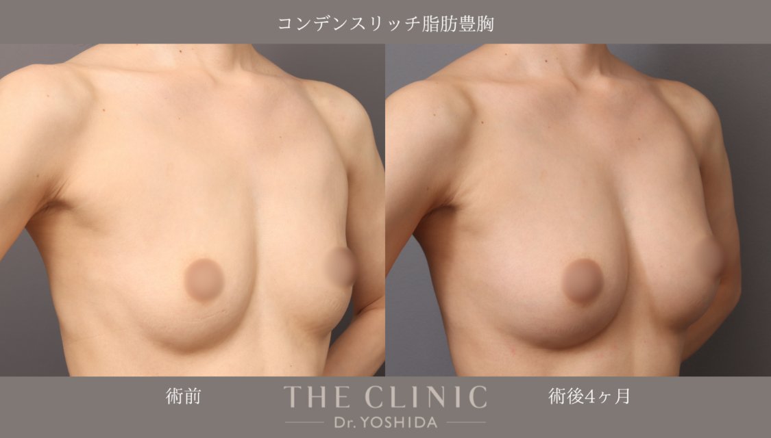 吉田有希 美容外科(JSAPS)専門医|脂肪吸引・豊胸専門_THE CLINIC(ザ・クリニック) tweet media