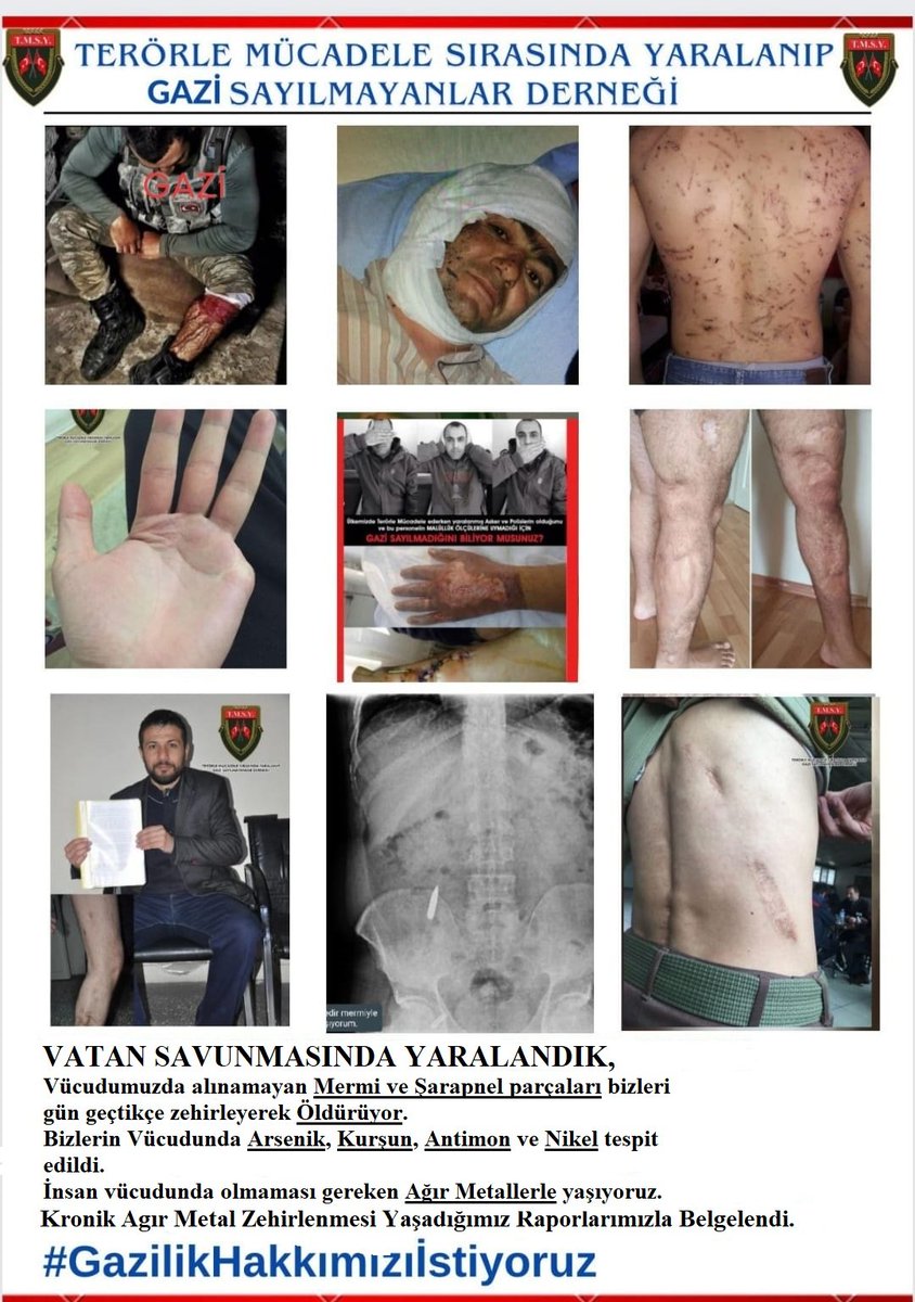 asyabeha21752's tweet photo. #GazilikHakkımızıİstiyoruz 
Terörle Mücadele ederken yaralanıp, yaralanma derecesine göre Gazi sayılmayan polis ve askerler Millî Savunma Komisyonundan gelecek haberi bekliyor Şehidin şahidi olduk ama Gazi değiliz vücudumuzda izlerini taşıyor
@celebimehmeta 
Neyi bekliyorsunuz https://t.co/nrCGKHwYvD