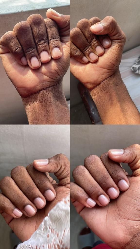 brownbelieve7's tweet photo. What kind of cream can transform my fingers to look this beautiful and clean? https://t.co/BeRJMDUYyj