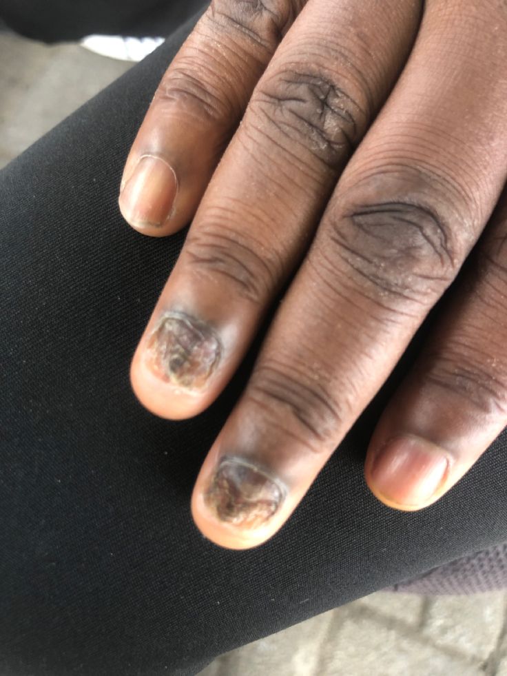 brownbelieve7's tweet photo. What kind of cream can transform my fingers to look this beautiful and clean? https://t.co/BeRJMDUYyj