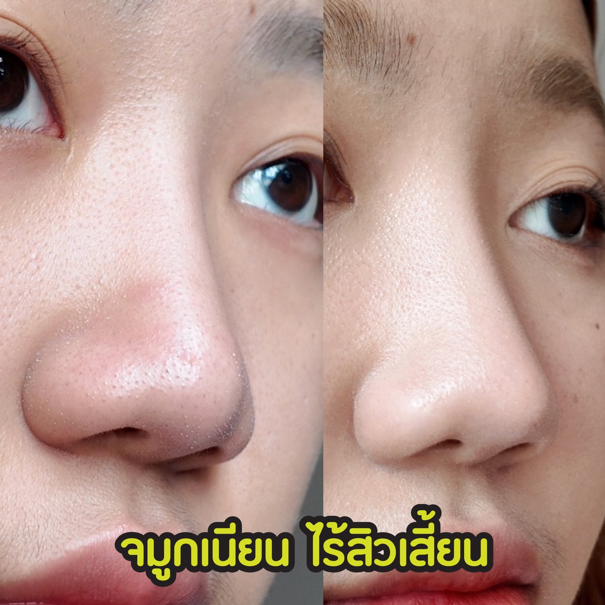 th_theoriginal's tweet photo. จัดการสิวเสี้ยน สิวหัวดำ สิ่งอุดตัน
ด้วยแผ่นลอกสิวเสี้ยน ดิออริจินัล
📍ซื้อได้ที่ 7-11 ทุกสาขา
#สิวเสี้ยน #สิวหัวดำ #ลอกสิวเสี้ยน #รีวิวเซเว่น #TheOriginal https://t.co/6kt0kNclyQ