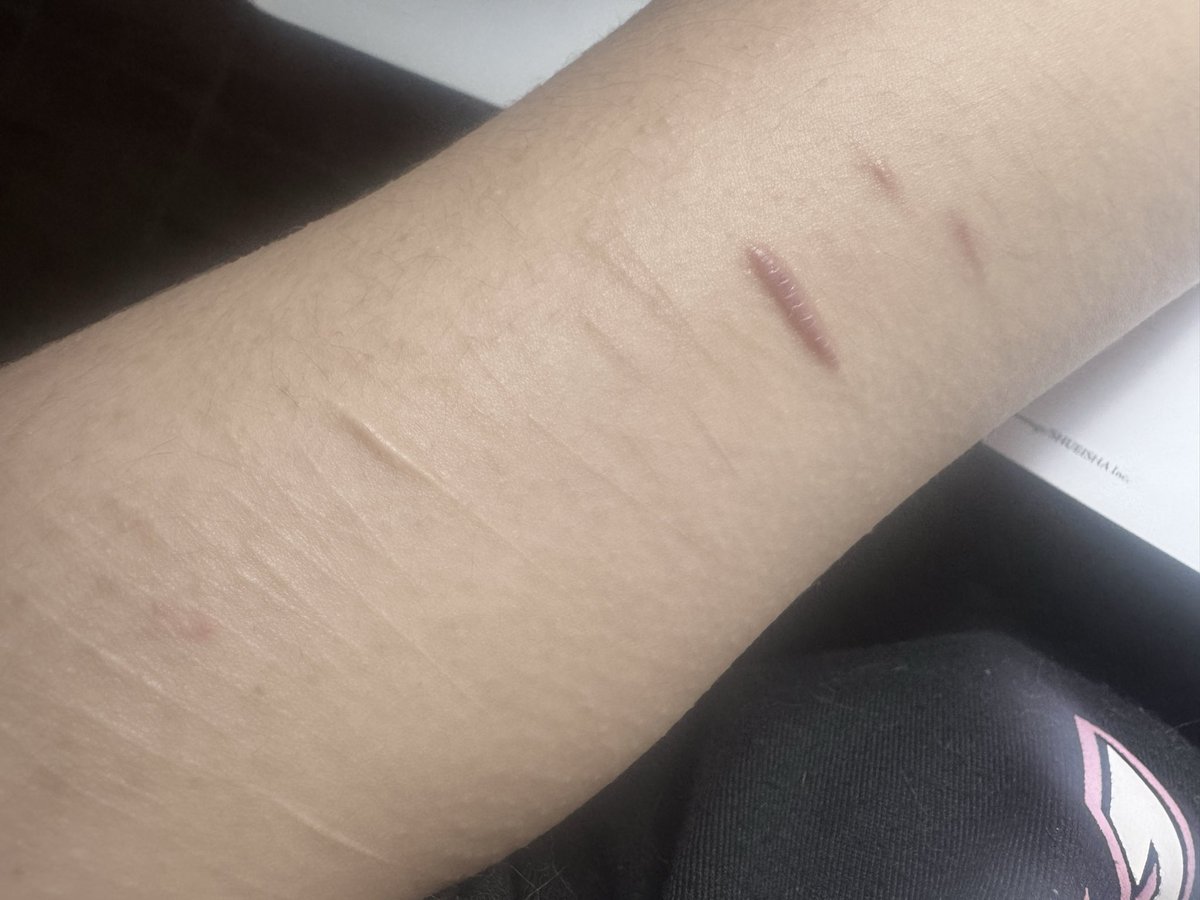 samwantstod1e's tweet photo. i’ll hurt myself if i want, i don’t care https://t.co/1Ja2yCVg7n
