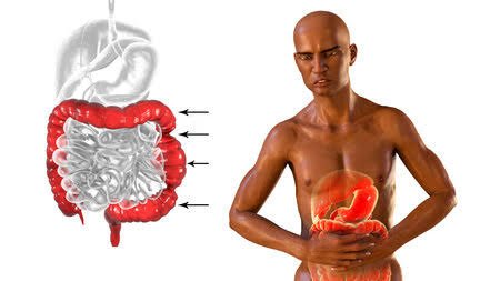 Sainte_Hermine5's tweet photo. Vous avez déjà ressenti cette douleur soudaine, aiguë et tordante au fond du ventre ? 

Les crampes intestinales peuvent gâcher une journée en quelques secondes.

Aujourd'hui, mes champions, on s'attaque à ce problème avec un secret bien gardé. 🧵 https://t.co/bQrP2HKnnN