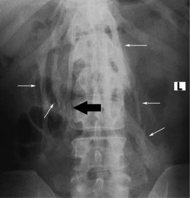 FabledFelts's tweet photo. @albertoortegana @THEMEDFACT23 Accurate! That x ray isn't FOP. FOP doesn't present as buckshot. https://t.co/KxxIX6fNFn