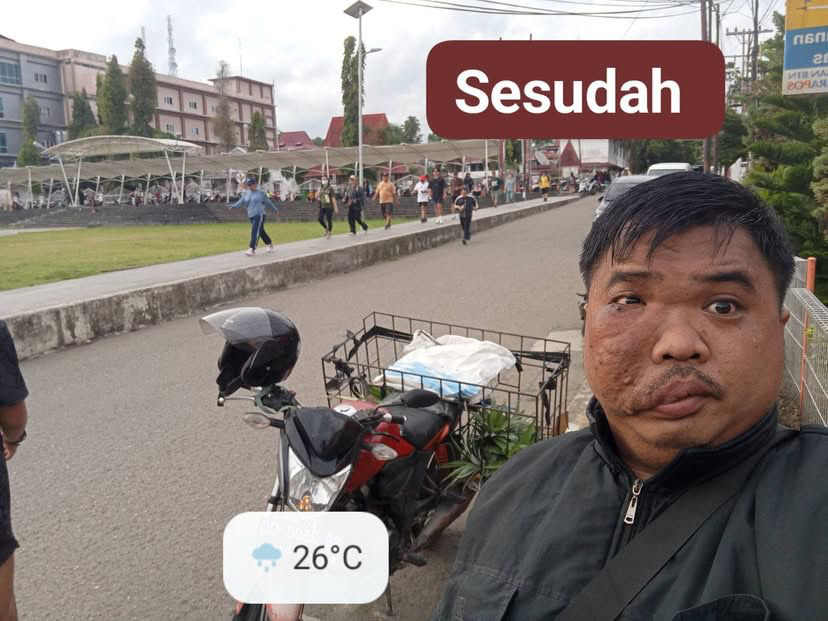 LambeSahamjja's tweet photo. cerita bapak paulus menginspirasi bahwa keterbatasan bukan halangan:
- jual nenas hasil kebun sendiri di gunungsitoli
- panen nenas dari kebun sendiri, 
- dibawa ke alun-alun kota gunungsitoli untuk dijual
- jualan nenas keliling bukan buat kaya, cuma buat sambung hidup
- jualan pakai motor mulai dari 4 sore sampe habis 
- nenas 55 buah habis terjual semua
- ucapkan terima kasih ke orang-orang yang sudah beli/bantu sebar