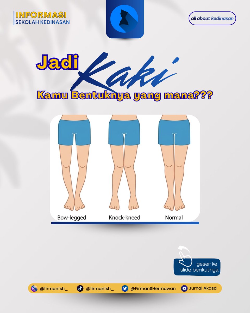 FirmanSHermawan's tweet photo. Jadi Kaki kamu bentuknya yang mana??? https://t.co/ukDPr3Awpg