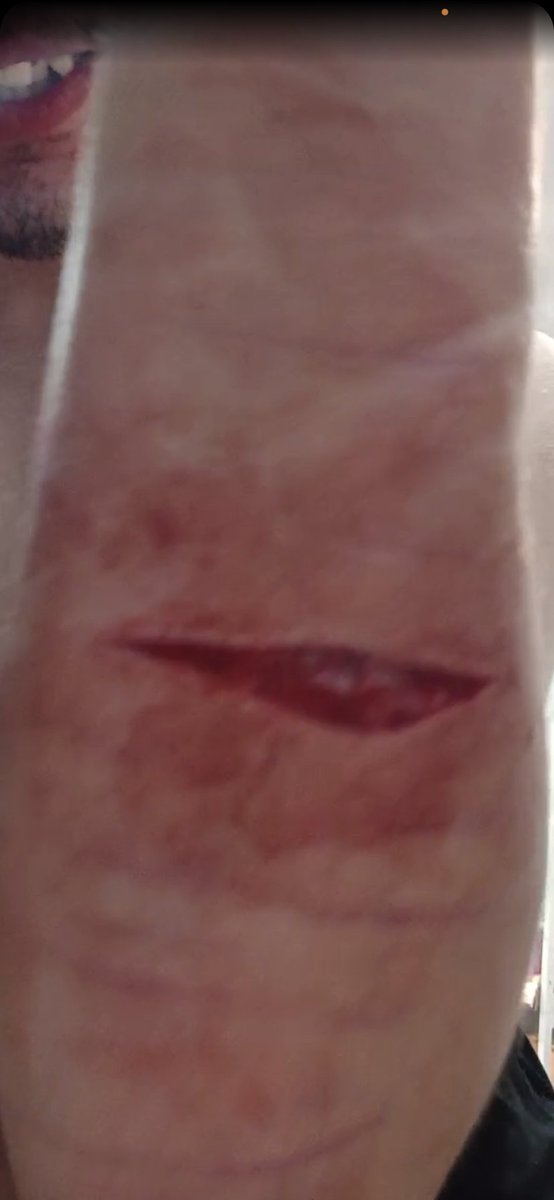 SmithTanker's tweet photo. Pov you did your cut right for once https://t.co/Lsiv2JHu9L