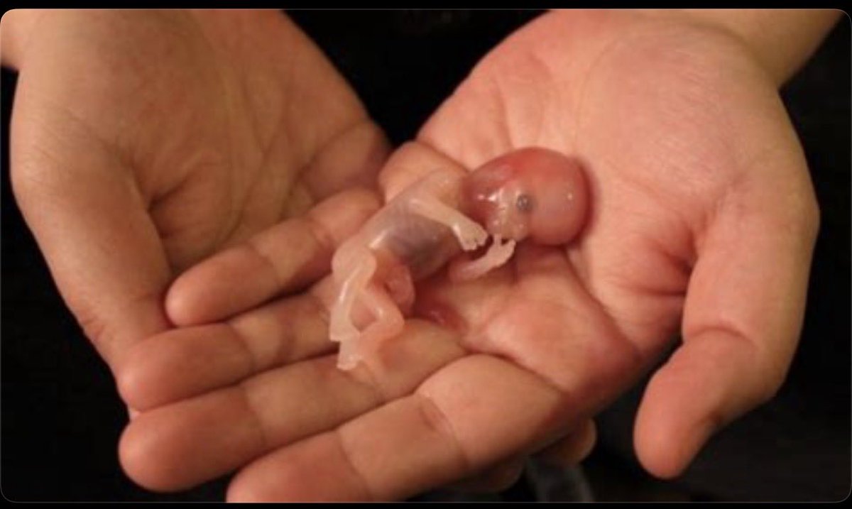 thriftdaniel1's tweet photo. Abortion is the cold-blooded murder of the most innocent of human life…. https://t.co/Z01eFbqcnY