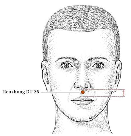 itellsya's tweet photo. @freddyzur 'Pressing on the philtrum stimulates the trigeminal nerve, which can quickly interrupt stress [..] it is also used as an acupressure point (DU26) to boost alertness[.]  

In traditional Chinese medicine it was used to "restore consciousness" or help revive someone fainting.' https://t.co/UUNBb8fJ1x