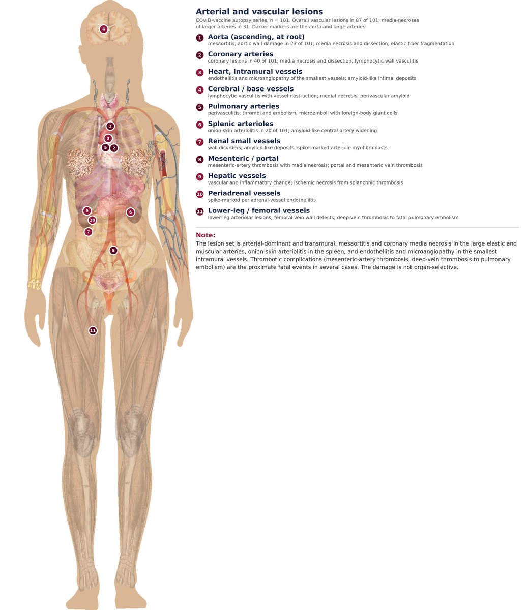 rwc137's tweet photo. @FlashlightsPod @r_hirschman @NicHulscher @OlooneyJohn Bio distribution data from Pfizer. The rest is from Burkhardt/Lang/Schwarz 192 case of autopsies and biopsies after Covid vaccination. https://t.co/JyfTMnUQnF