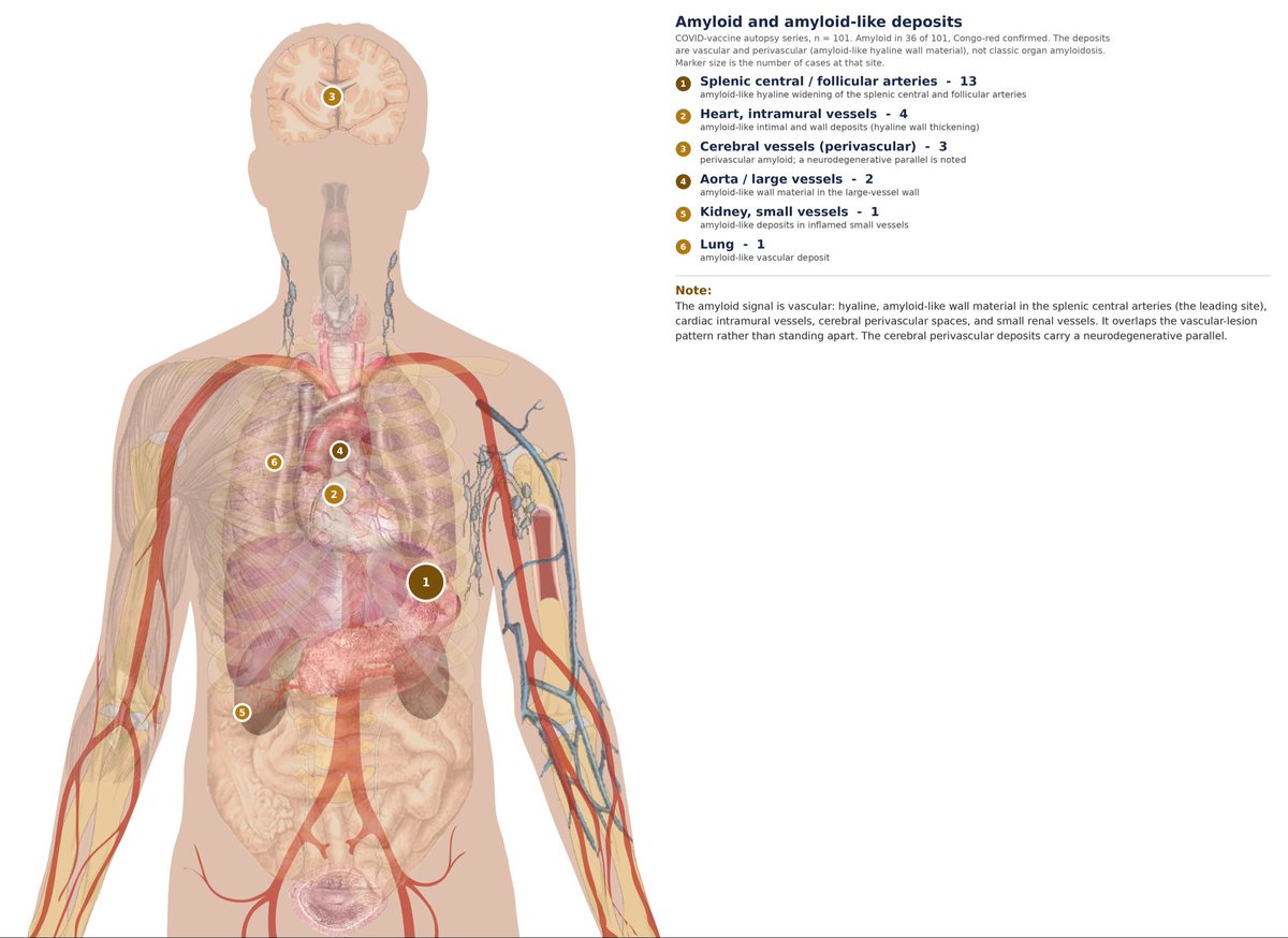 rwc137's tweet photo. @FlashlightsPod @r_hirschman @NicHulscher @OlooneyJohn Bio distribution data from Pfizer. The rest is from Burkhardt/Lang/Schwarz 192 case of autopsies and biopsies after Covid vaccination. https://t.co/JyfTMnUQnF