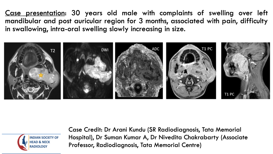 teamishnr's tweet photo. #caseoftheweekanswer

Please find the answer
#radiology #caseoftheweek #headandneck #radiologycases #dailywork #ISHNR #teaching #research #imaging #FOAM #FOAMRad #FOAMMed

Visit our website: https://t.co/vNnEDhrCfI
All Cases: https://t.co/0xaPvoBy5H https://t.co/YDdYOLjBxh