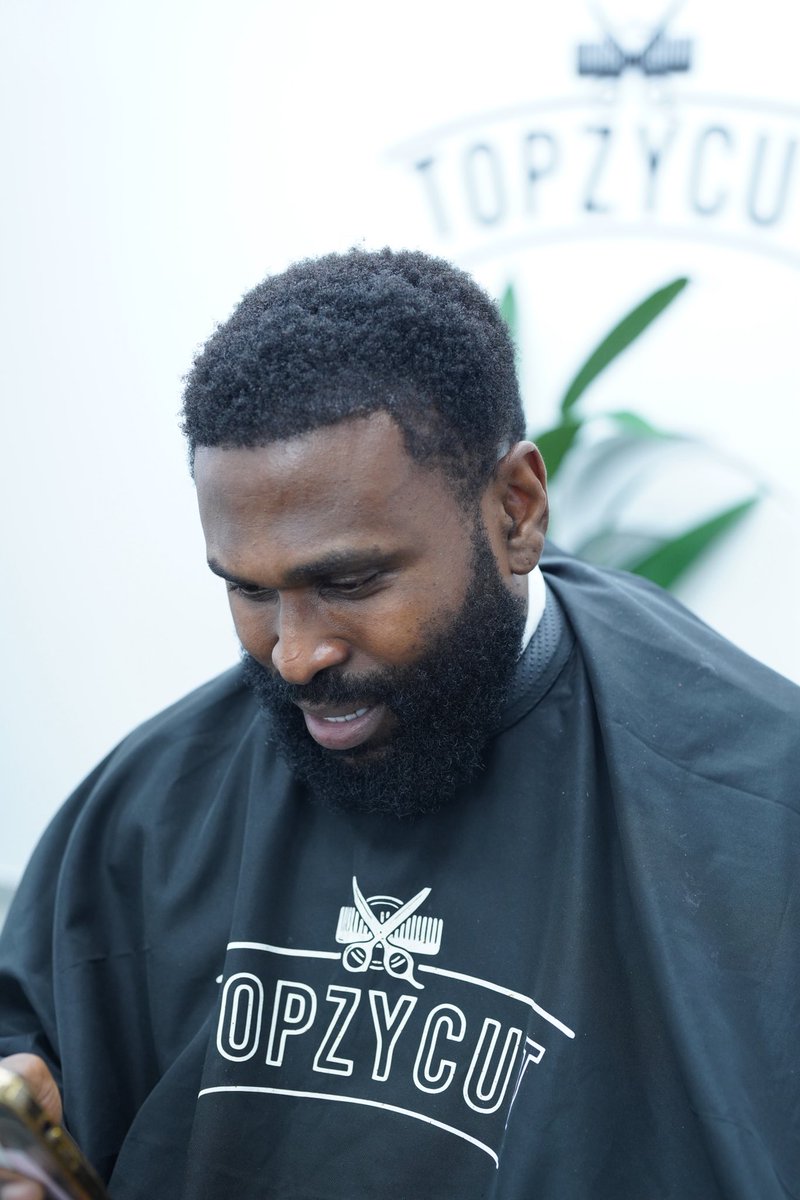 Topzycut's tweet photo. My client few years back before hair transplant vs now… a sign to invest in your look https://t.co/pOQoUl7SpY