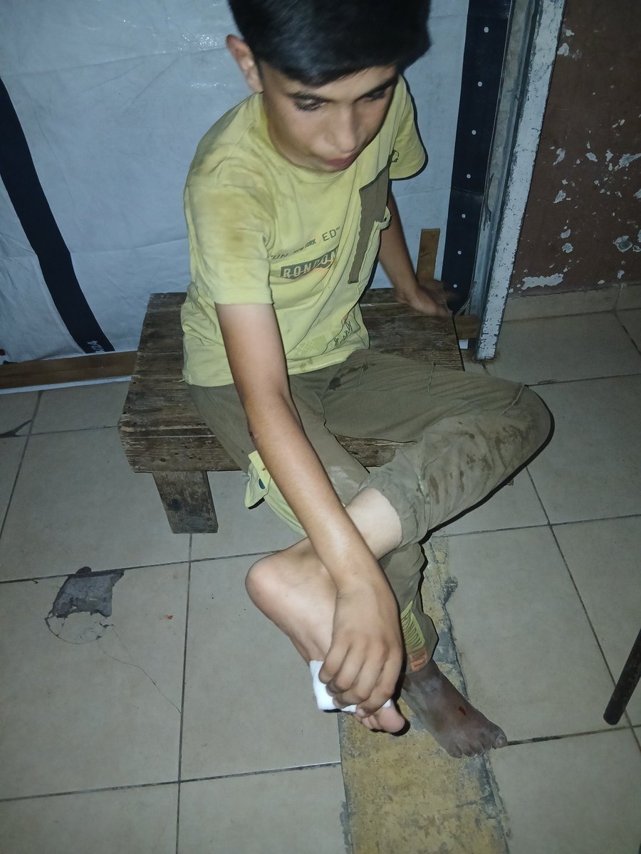 mahaedwan171934's tweet photo. Yousef stepped on a piece of broken glass from the rubble in the street, causing a deep injury to his foot.
He is in severe pain, and we need your support to help him receive treatment and recover.
Please help us. 
https://t.co/weCCemrzgx https://t.co/yc0SjroGpw