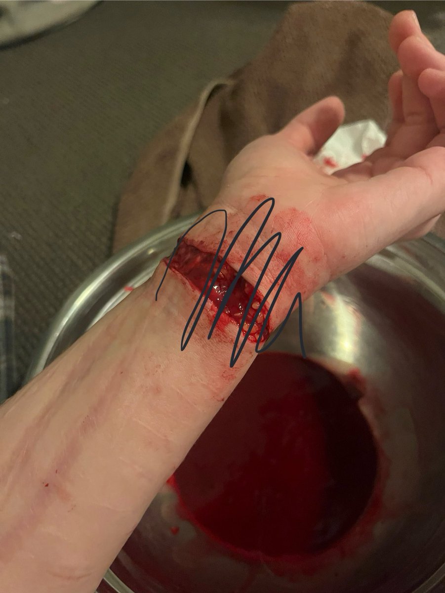 cutsnwounds's tweet photo. Tw // fake but realistic shown injury 

Imma keep going. https://t.co/FjOCm8WwPb