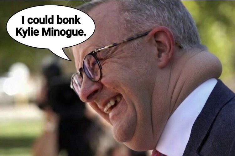 GoDees2021's tweet photo. @OneAussieChick He’s pathetic but woketard lefties are asleep and they’re violent retards. https://t.co/CDsPS60k4c