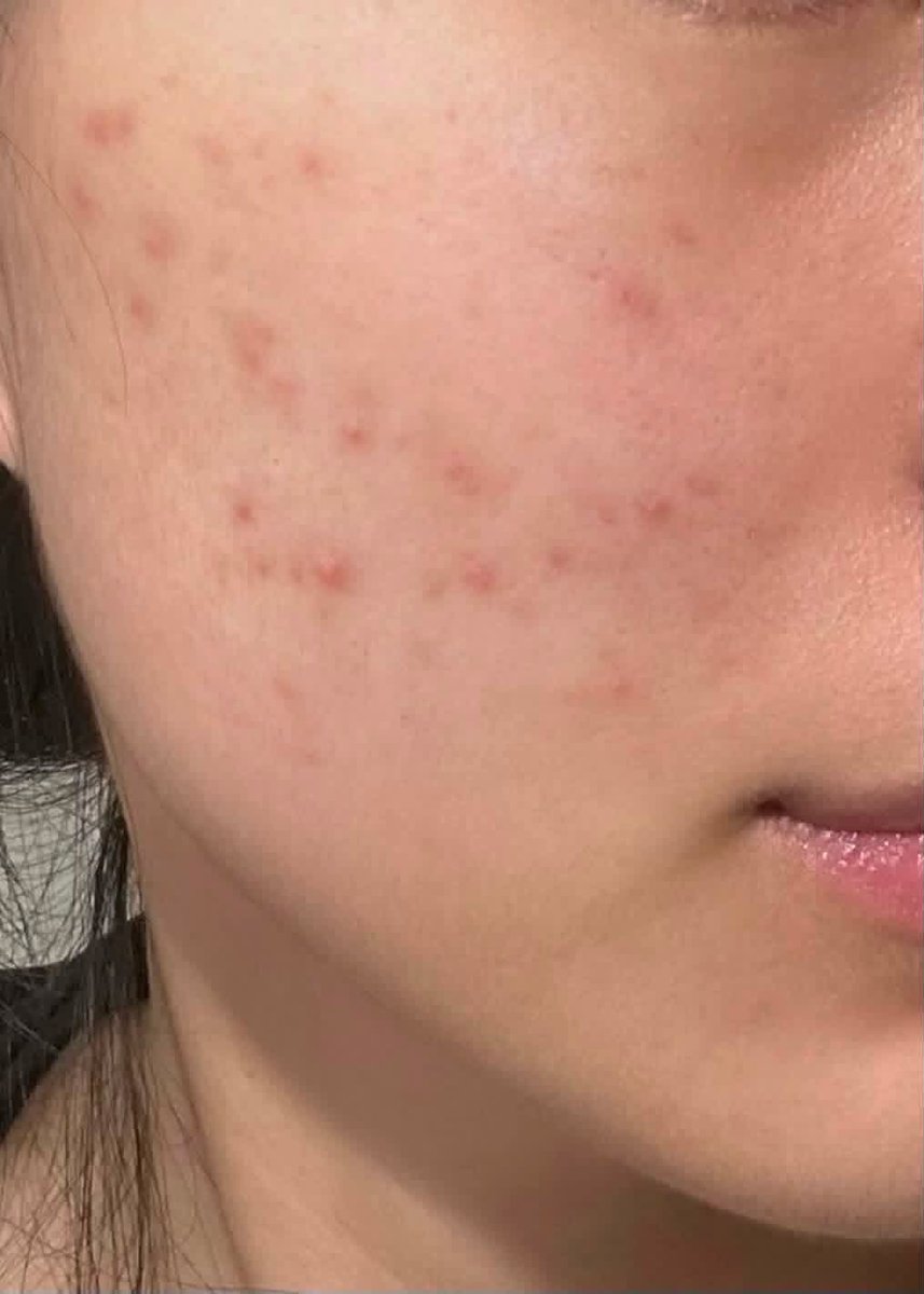 gbbriell1's tweet photo. ANJIR.. kenapa ga ada yg kasih tau kalau hypoallergenic + dermatologically tested itu penting banget buat kulit reaktif 😭￼ https://t.co/TgimTsRHAV