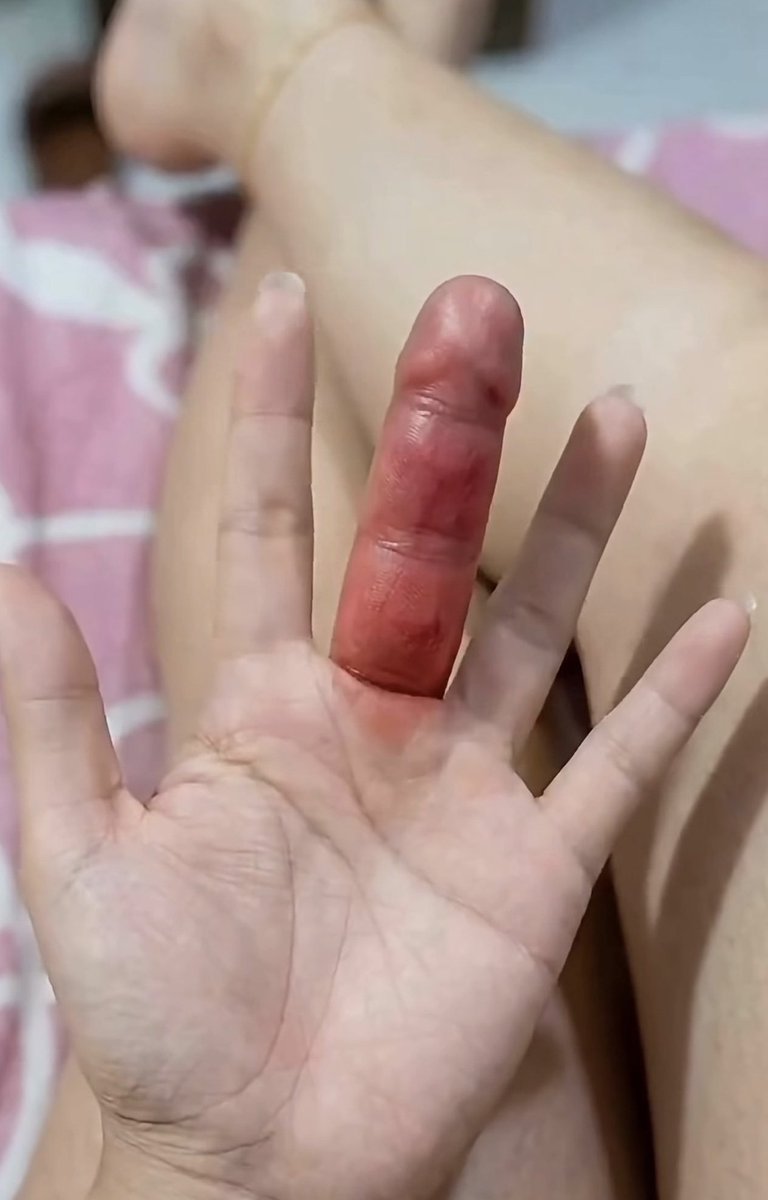 1d3co's tweet photo. Doctors on my TL help me get the fire for this disease please.
This Saba Saba day Must not end in pain. https://t.co/041OOR9grm
