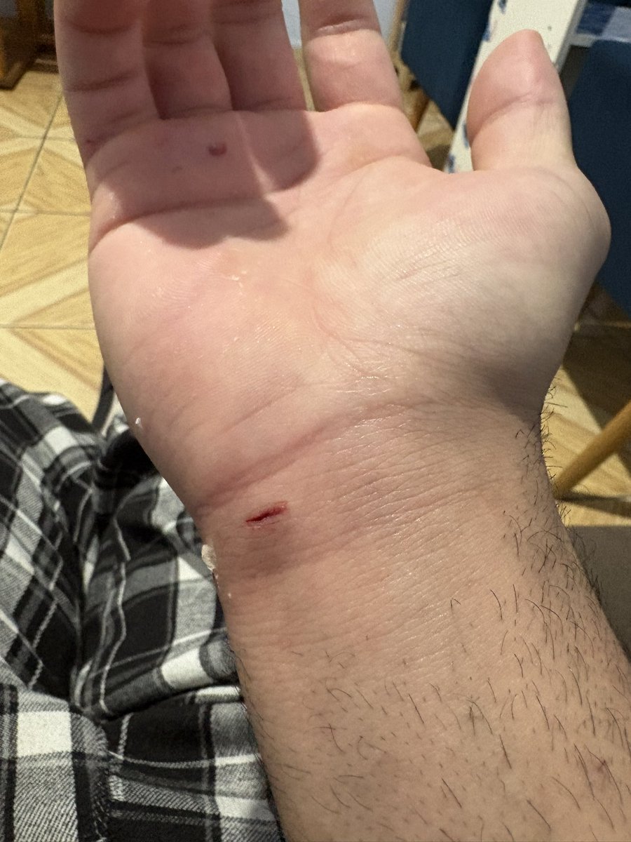 ryanzinhofdp's tweet photo. e eu q sai na porrada com um gato de rua q tava fedendo a carniça https://t.co/kDPSz09vUr