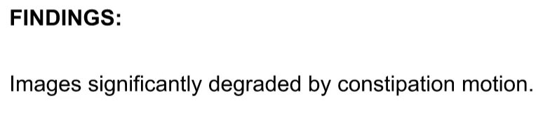 JamesHaddadMD's tweet photo. New level of #GI unlocked 💩

#GITwitter #GIX #MedTwitter #MedX #Radiology https://t.co/KVeGQ42hjm