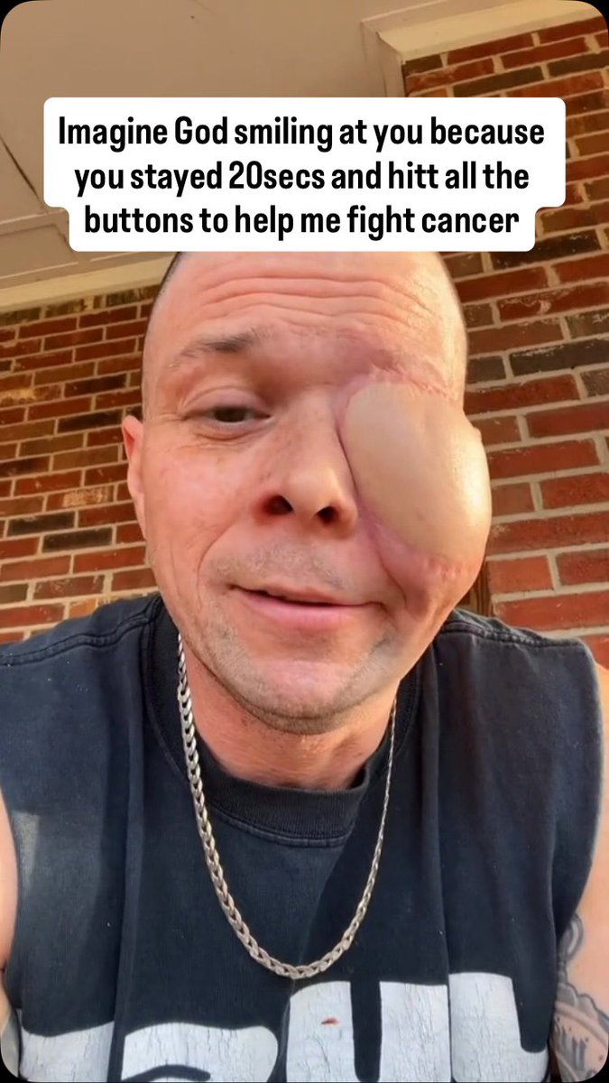 AlexanderR976's tweet photo. 💔 My life changed forever when I was diagnosed with eye cancer. Every day brings difficult treatments, rising medical bills, and uncertainty, but I refuse to lose hope. Your support, prayers, or even a simple share means more than words can express. 🙏❤️ https://t.co/8584vswnYI