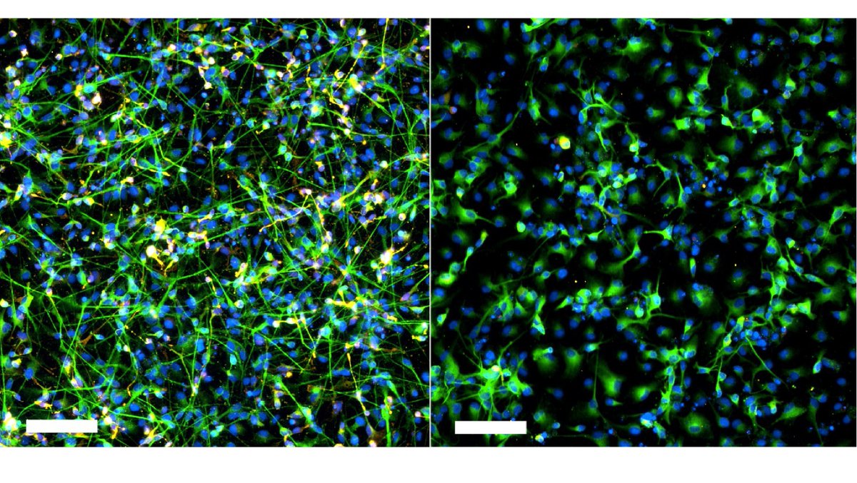 Alt text: Cells in the brain dyed in green and blue stain, showing how adding an inflammation molecule prevents neuron production