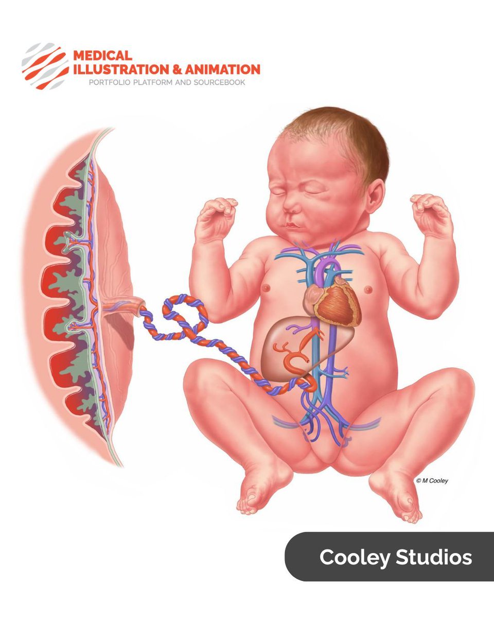 Medillustrates's tweet photo. Cooley Studios | Michael A. Cooley delivers a masterfully detailed and vibrant look at developmental anatomy with this digital medical illustration of the fetal circulatory system.
Explore more: https://t.co/UxvexBXMl5
#cooleystudios #medicalillustration #fetalcirculation https://t.co/GzNGNnCe7B