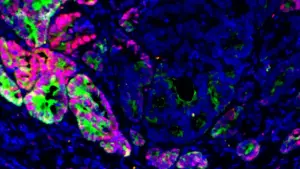 RobyChil's tweet photo. Gli scienziati scoprono come le #cellule del #cancro al #colon #cambiano #identità per diffondersi
identificato un fattore chiave che potrebbe favorire la #diffusione del #cancro del colon-retto al #fegato…
Continua a leggere qui: https://t.co/d44CBCokUH https://t.co/1gcTH0F6NC