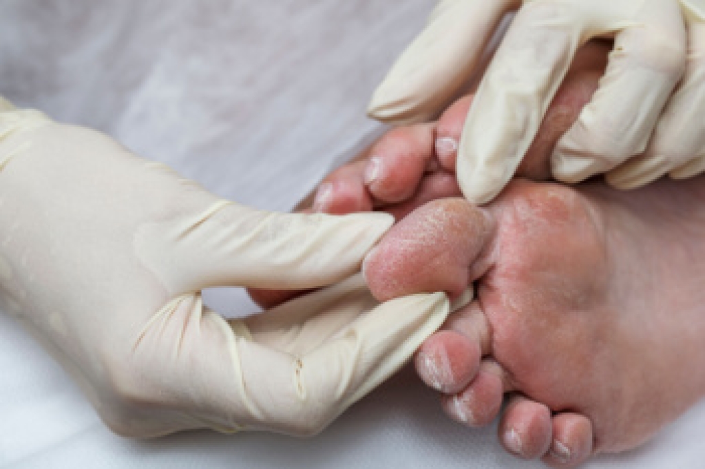 drmilesdawn's tweet photo. How a Podiatrist Helps With Diabetic Foot Care https://t.co/gLbARX5tVH https://t.co/FGnF7wWy5X