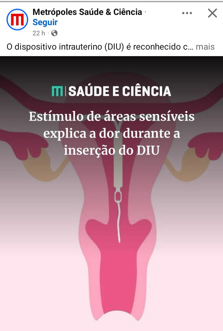 langelima's tweet photo. e não é só na hora da inserção do diu que dói. Dói depois, mas não se ouve falar... É um desconforto constante https://t.co/7LCtblWqGh