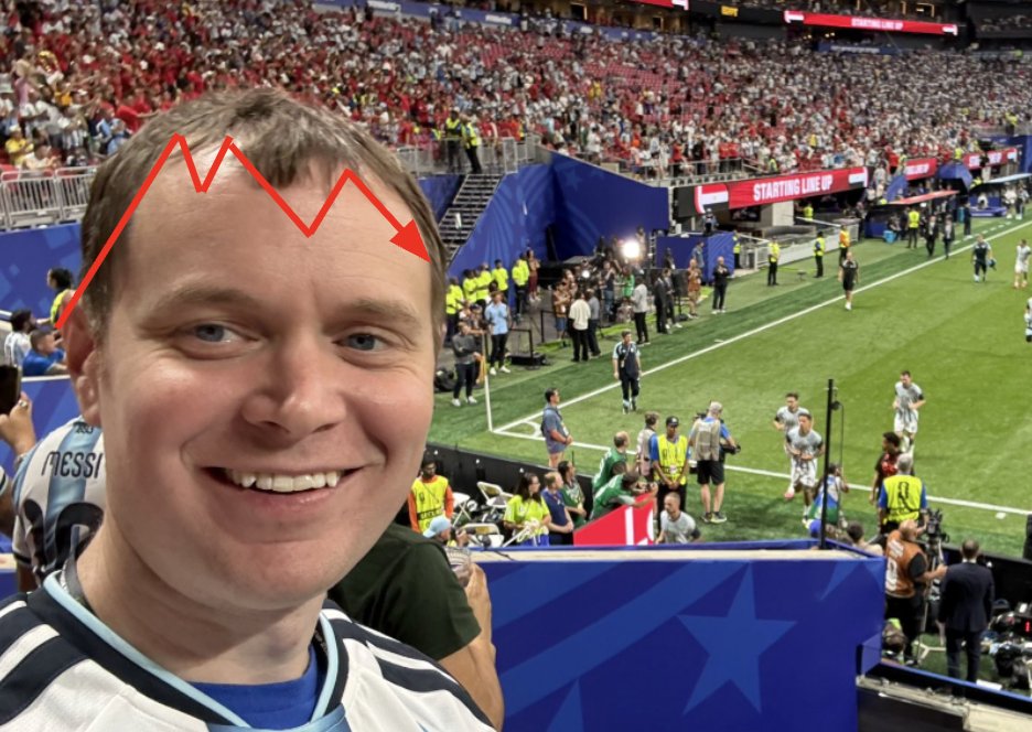 MBasaure's tweet photo. @benjamincowen Forehead looks super bullish.... https://t.co/QpwPRmCo7c