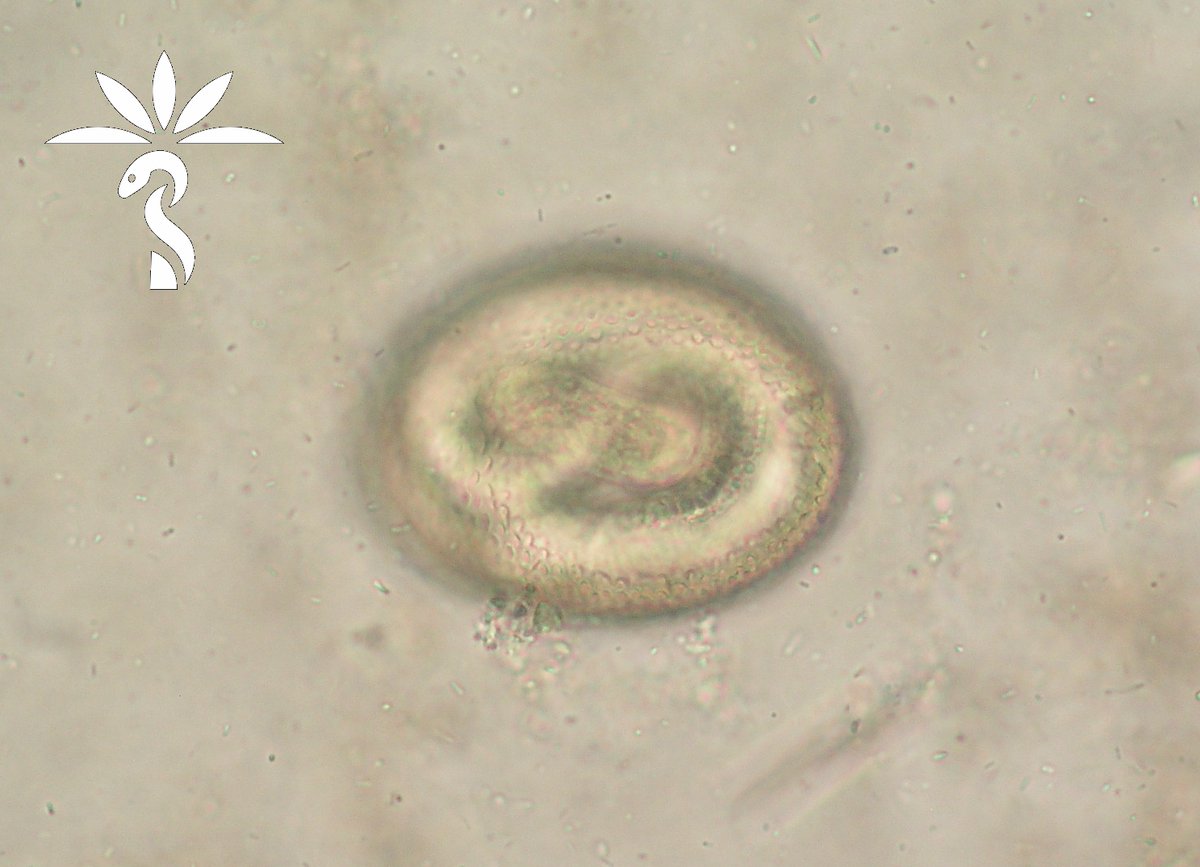 ParasiteGal's tweet photo. #Parasite Case 814 is up - donated by Idzi Potters and @ITMantwerp : object found in the soil from a playground. What is your ID? And what is the potential significance of this finding? https://t.co/quwJtDDWf9
Ans later this week! #mayopath #pathology #PathBugs #CrittersOnTwitter https://t.co/VjeQPQJFGM