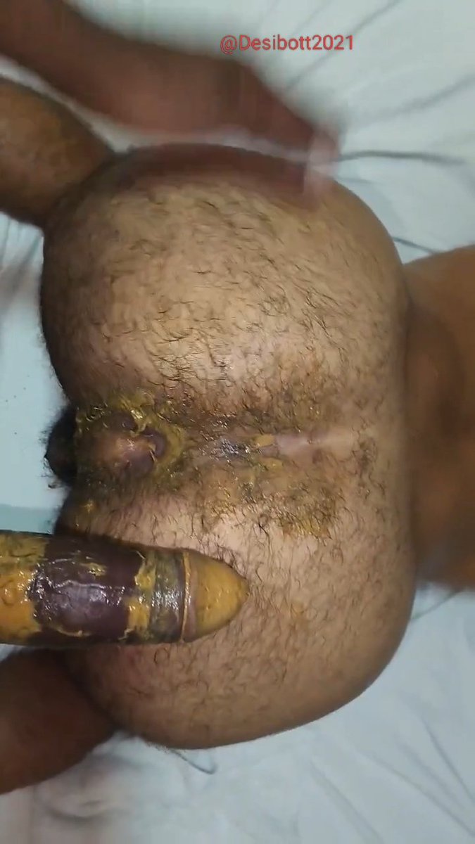 desibott2020's tweet photo. Shit-fuck 💩 One of the most amazing feeling in the world, when your partner wants you to shit it out while he is fuckin u deeper &amp; deeper with his boner একেই বলে চুদে চুদে পুটকির খাল বানিয়ে গু বের করে দেওয়া https://t.co/QAg4EPP6Wv
