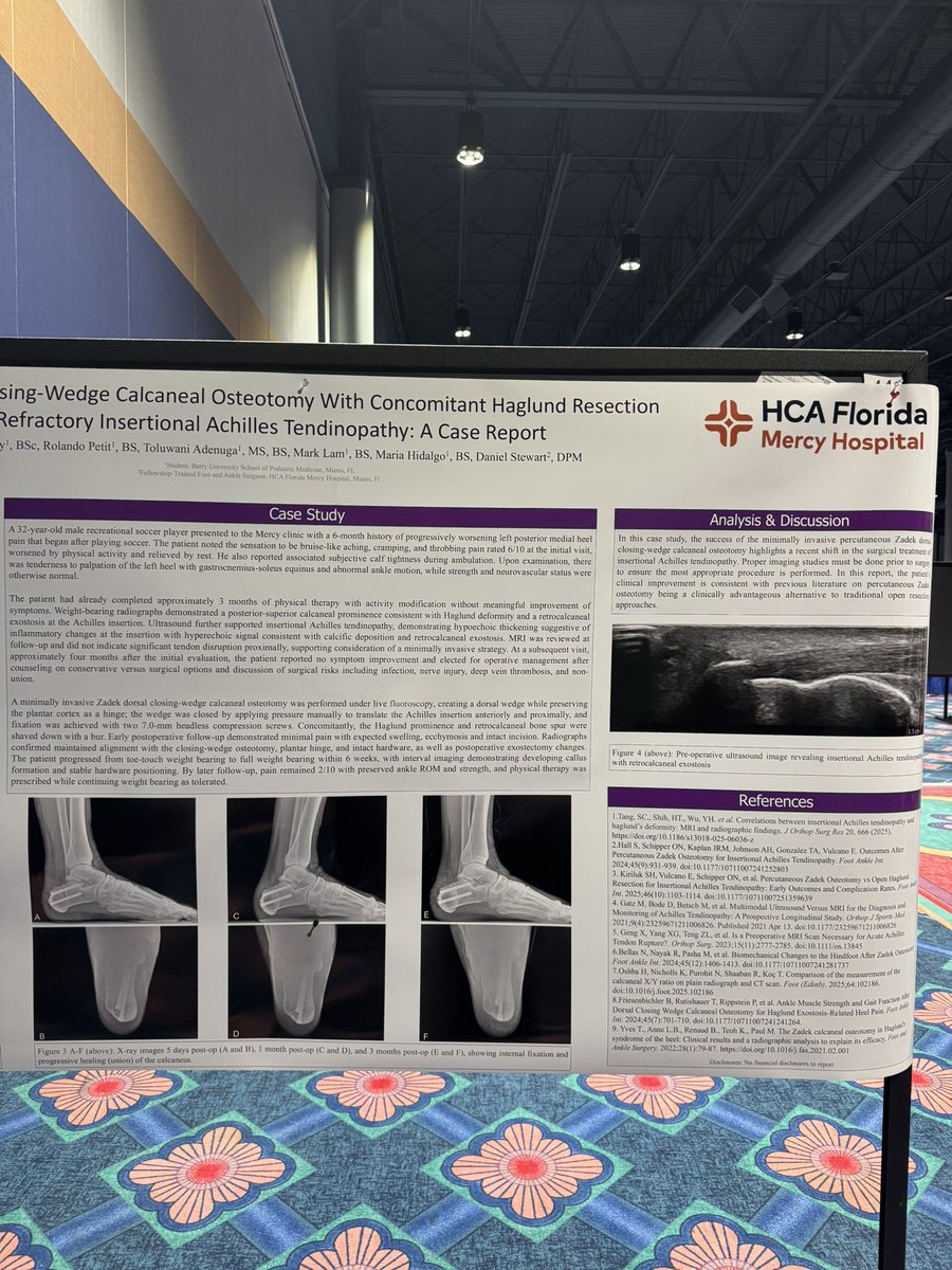 ylfpodiatry's tweet photo. 1/28/26 - 2/1/26 | Florida Podiatric Medical Association (FPMA) Science & Medical Symposium (SAM Conference) 2026: Zadek Dorsal Closing-Wedge Calcaneal Osteotomy Case Report & Poster Presentation

Proud to have presented my first scientific research poster at the Florida Podiatric Medical Association (FPMA) SAM Conference 2026 as a co-author and presenter. Our case report provided an opportunity to discuss current literature, clinical decision-making, and the application of minimally invasive surgical techniques for the treatment of insertional Achilles tendinopathy with physicians, residents, faculty, and fellow student doctors.

Presenting our case report at SAM 2026 was a rewarding milestone and an opportunity to engage with fellow students, residents, practicing podiatric physicians, and industry representatives while discussing current literature and evidence-based approaches to patient care. Experiences like these have strengthened my ability to evaluate clinical evidence, communicate scientific concepts, and appreciate the importance of collaboration in advancing patient care.

Thankful to my co-authors, faculty mentors, and the Florida Podiatric Medical Association (@FPMAtweets) for supporting student research and providing a platform to showcase our work. I look forward to carrying these experiences and perspectives with me throughout my career.

#SAM2026 #FPMA #PodiatricMedicine #ClinicalResearch #PosterPresentation