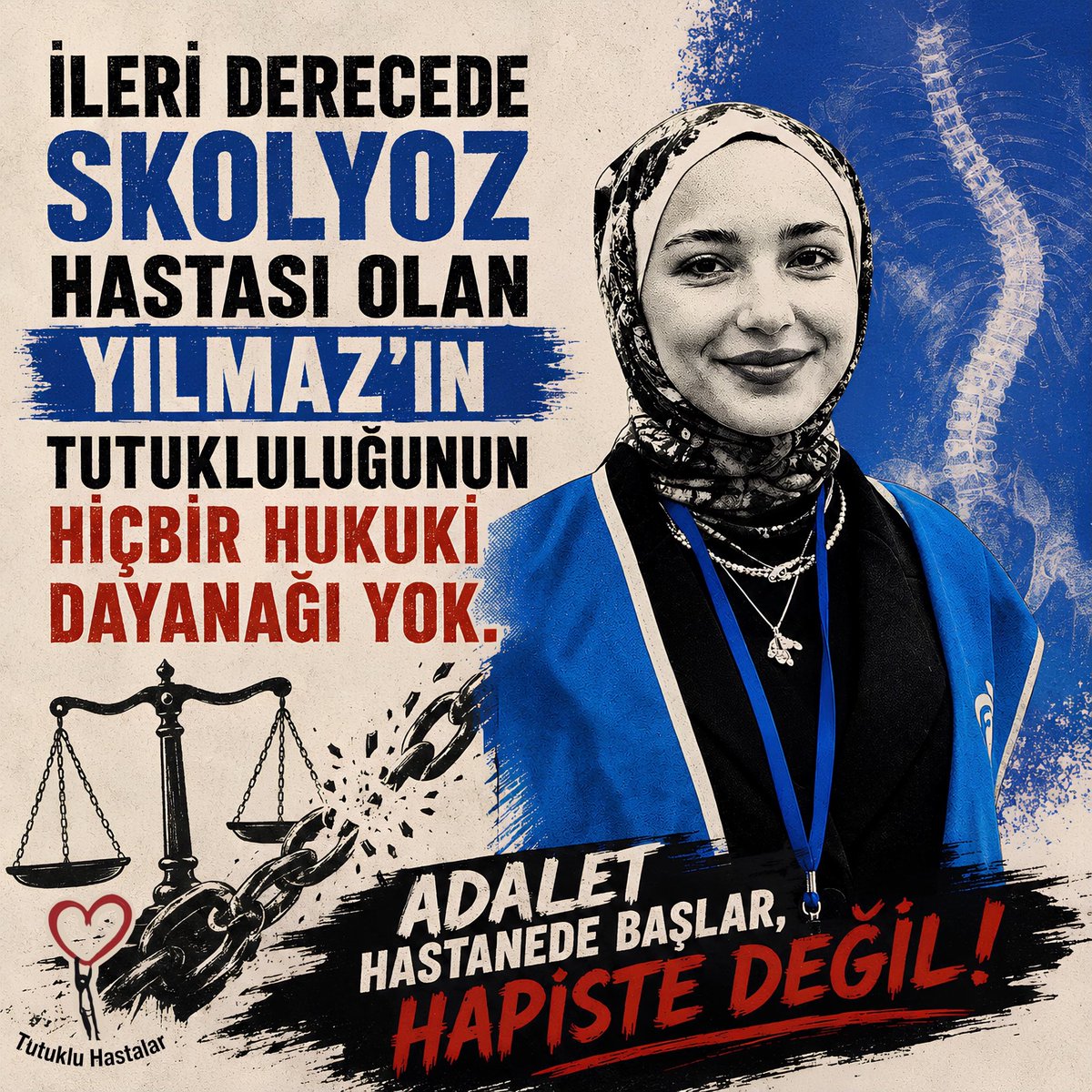 insan_sevgisii's tweet photo. İLERİ DERECEDE SKOLYOZ HASTASI OLAN YILMAZ'IN TUTUKLULUĞUNUN HİÇBİR HUKUKİ DAYANAĞI YOK.

ADALET HASTANEDE BAŞLAR, HAPISTE DEĞİL!

ÖğrenciMeryem NedenHapiste
#NATODefol https://t.co/xlNlrwZa13