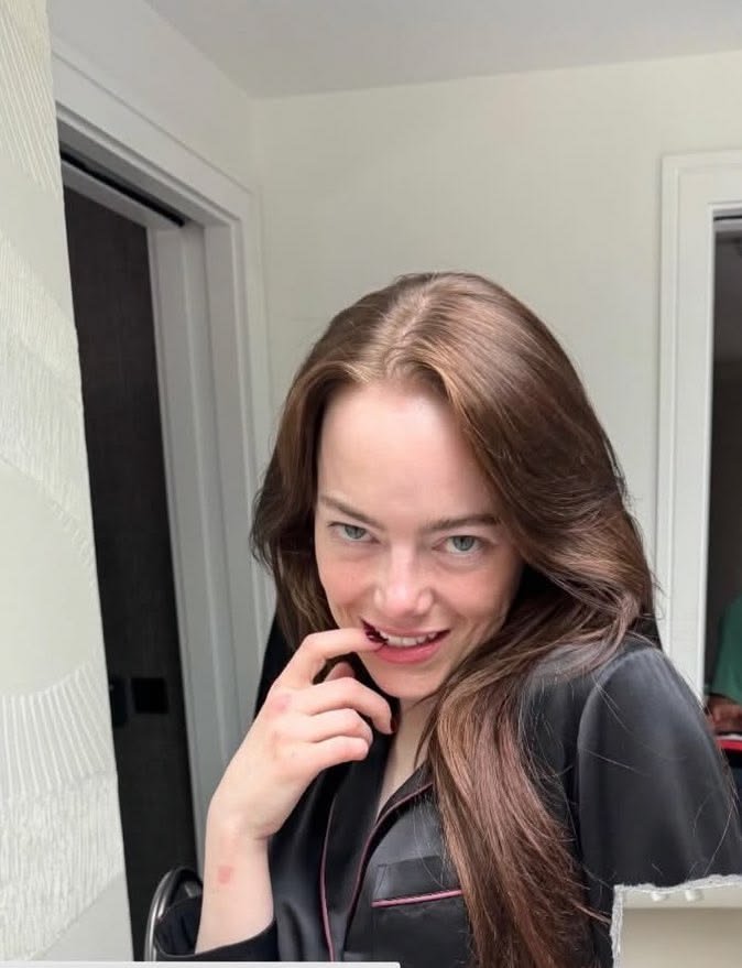 cinevow's tweet photo. Emma Stone, 2025 https://t.co/nlTNhR1FNt