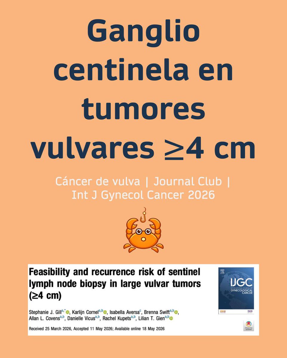 OncoGyn3's tweet photo. Ganglio centinela en tumores vulvares >4 cm? 🔬 Hallazgos principales:  La identificación fue exitosa en el 93.9% de los casos pero presentaron una tasa de recurrencia inguinal aislada significativamente mayor (15.6% vs 5.1%). 

 @IJGConline https://t.co/bNPAHAHxEt https://t.co/vvWhGcGpqK